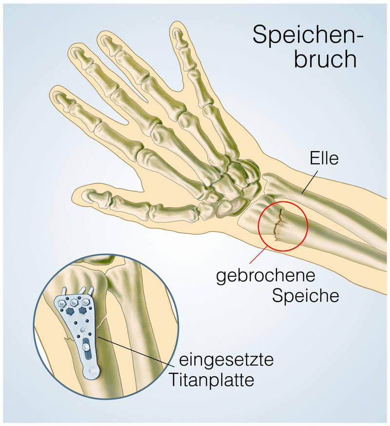 Bewegungen des Handgelenks