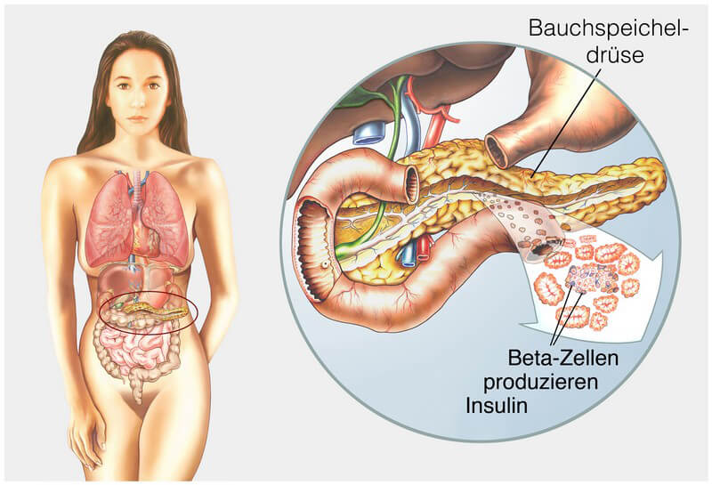 ringförmige Bauchspeicheldrüse